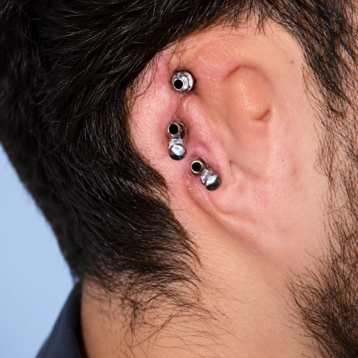 Implantes para rehabilitación auricular